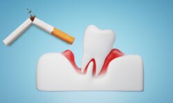 Smoking and Gum Disease