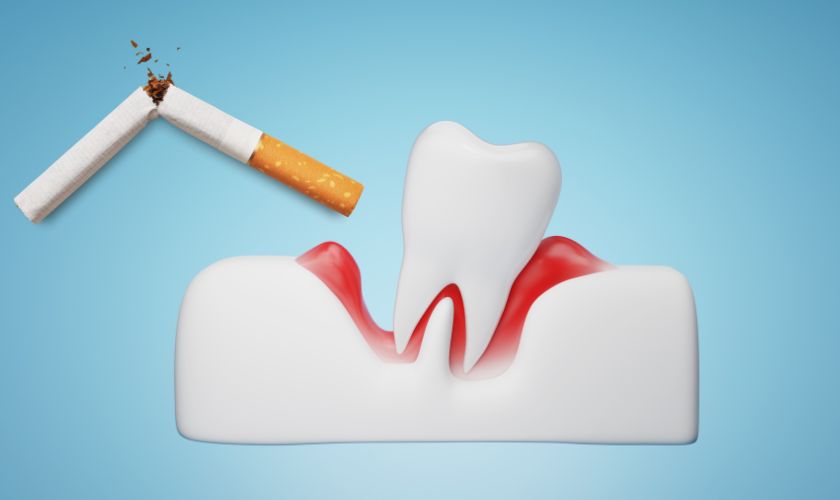 The Dangerous Duo: How Smoking Worsens Gum Disease